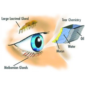 cataract-causes