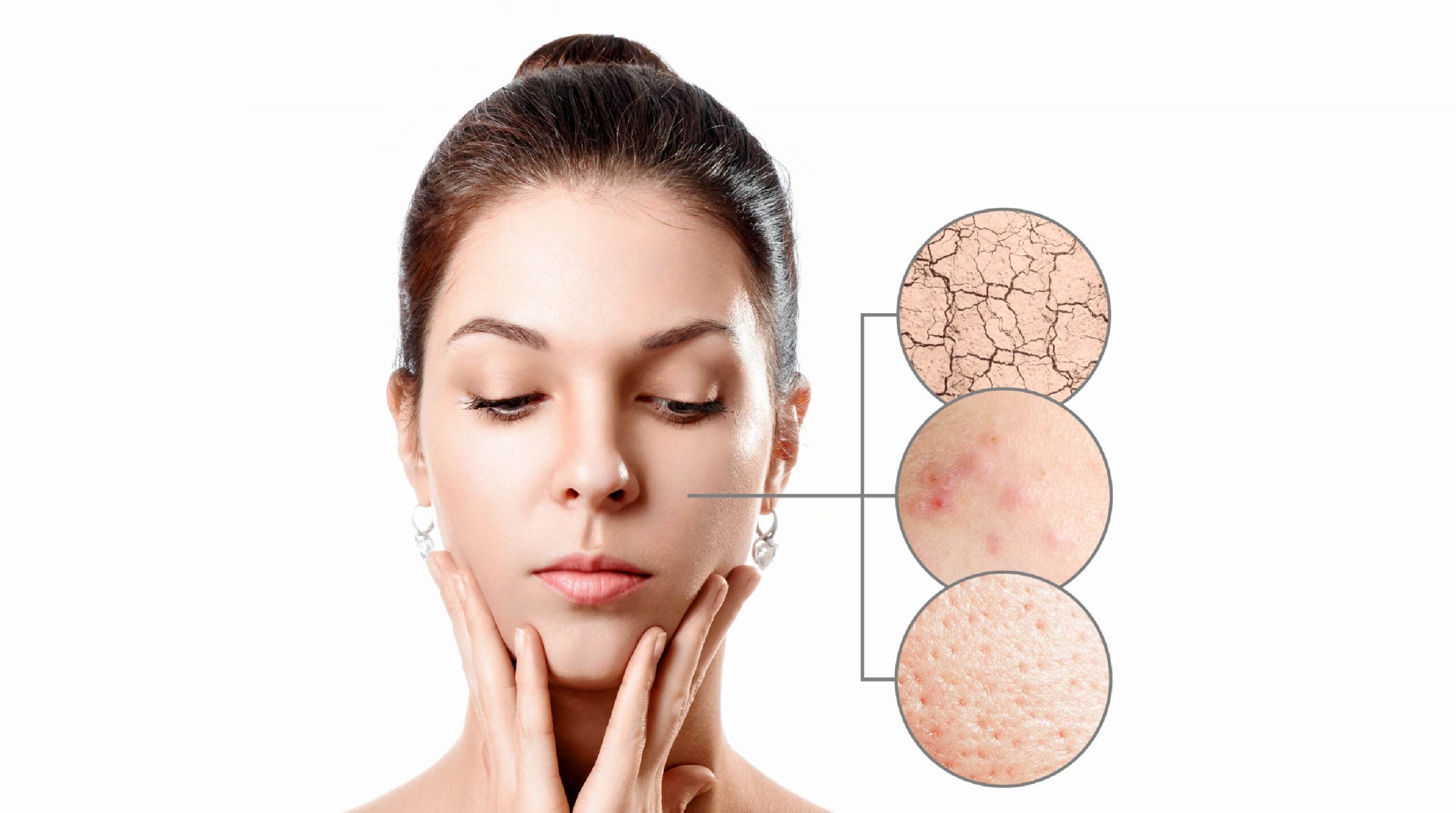 Combination Skin: Are You Taking the Right Care of It?