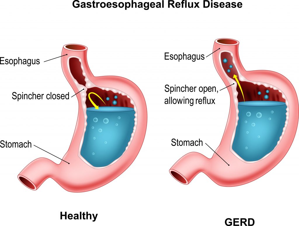 can-you-hear-your-stomach-is-screaming-for-help-sunlight-pharmacy